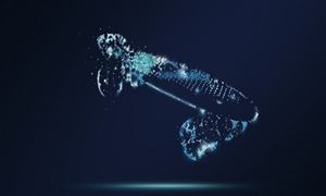 emc易倍：大米市场产量 2022大米行业发展趋势分析(图7)